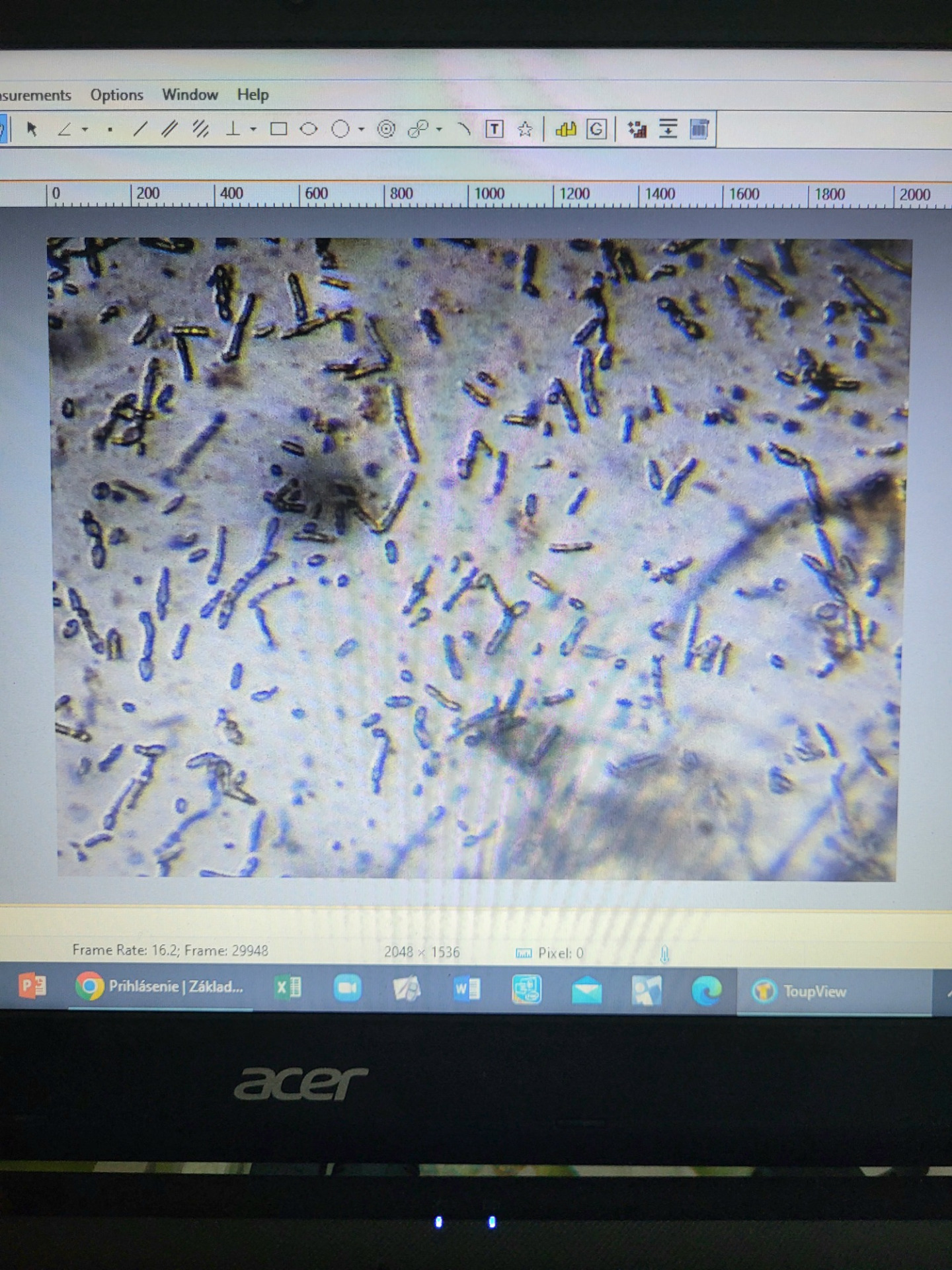 Octové baktérie pod mikroskopom - Obrázok 5